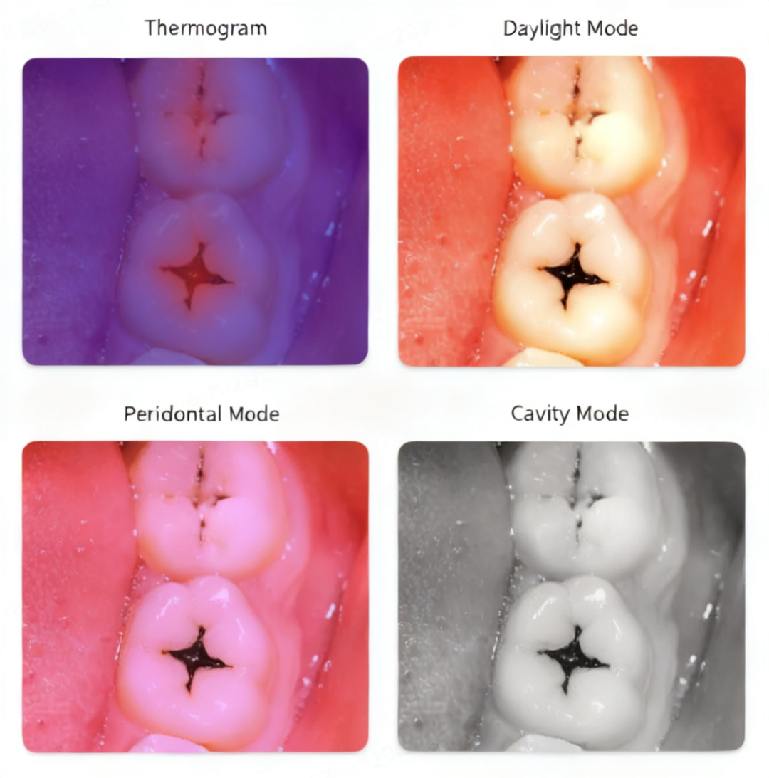 On-App AI Oral Detection: Multi-Level Classification Model + Heatmap Generation for On-Device Medical Imaging